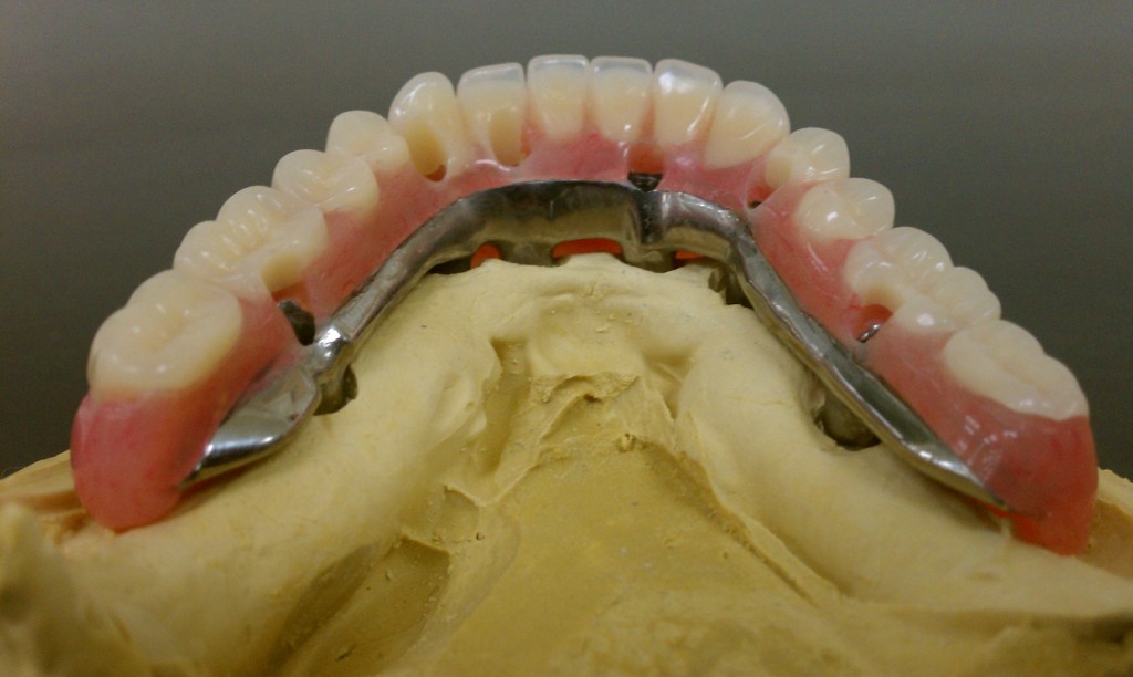 Steve's Precision Dental