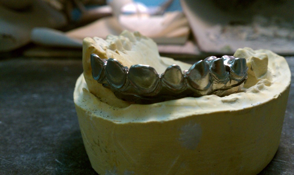 Steve's Precision Dental