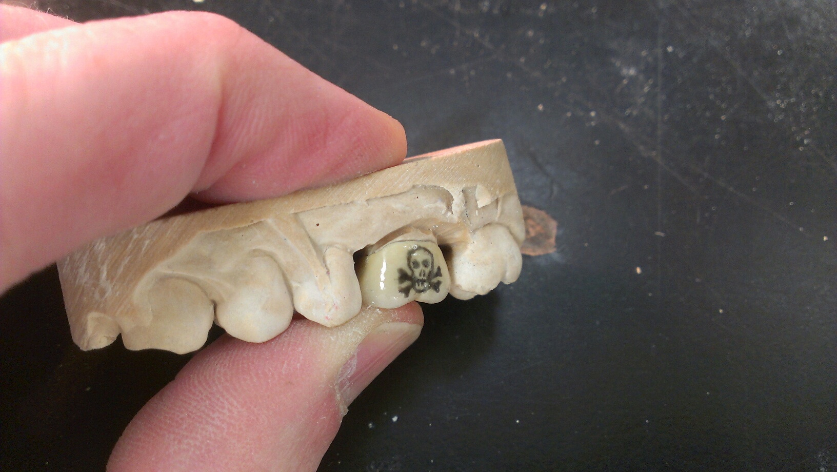 Steve's Precision Dental