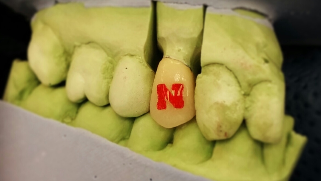 Steve's Precision Dental