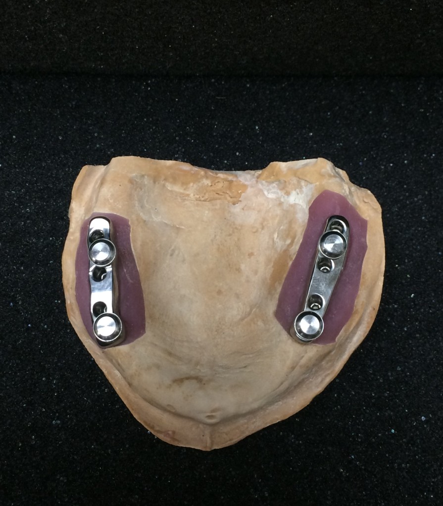 Steve's Precision Dental