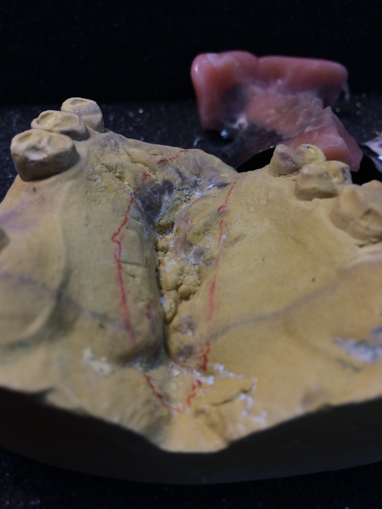 Steve's Precision Dental