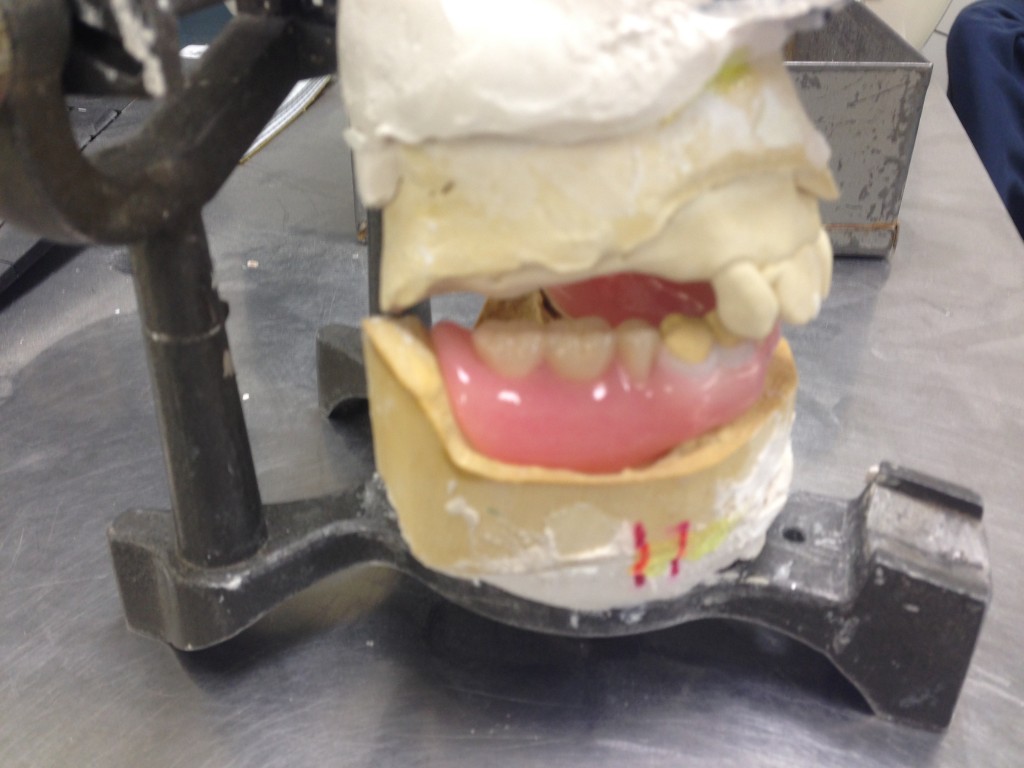 Steve's Precision Dental