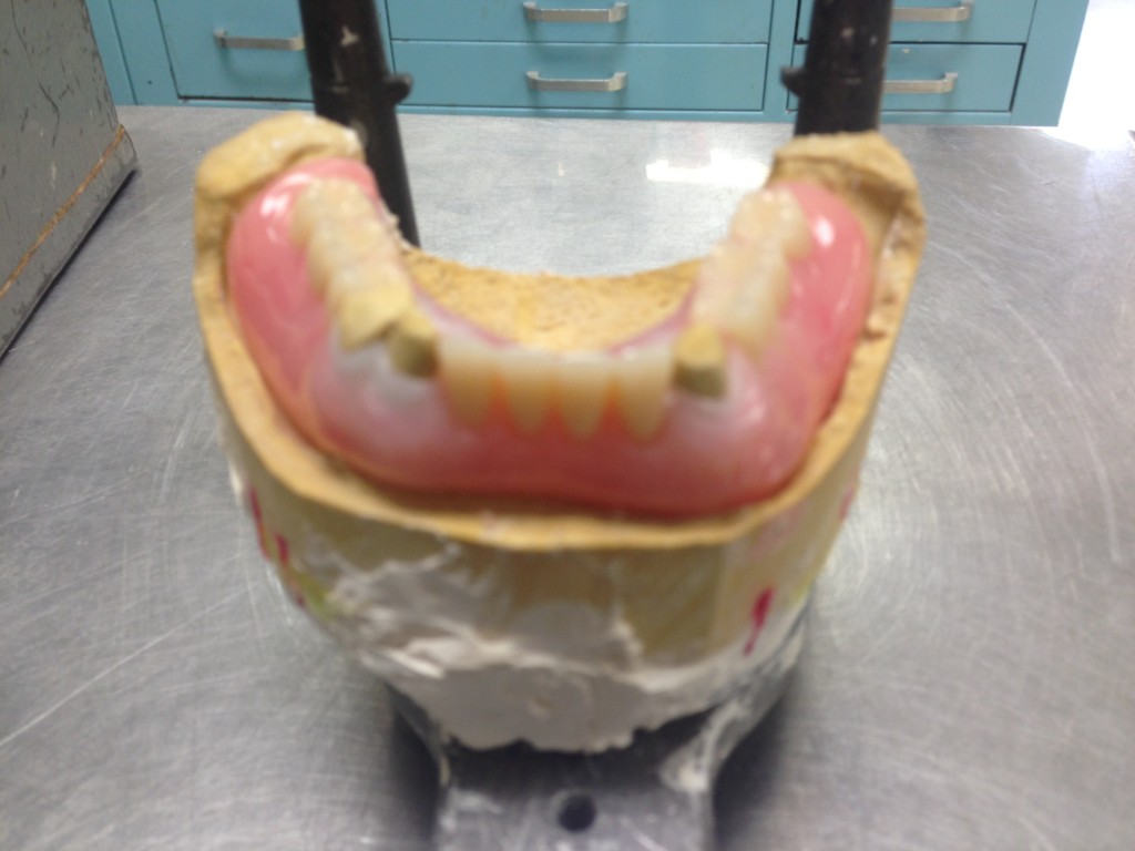 Steve's Precision Dental