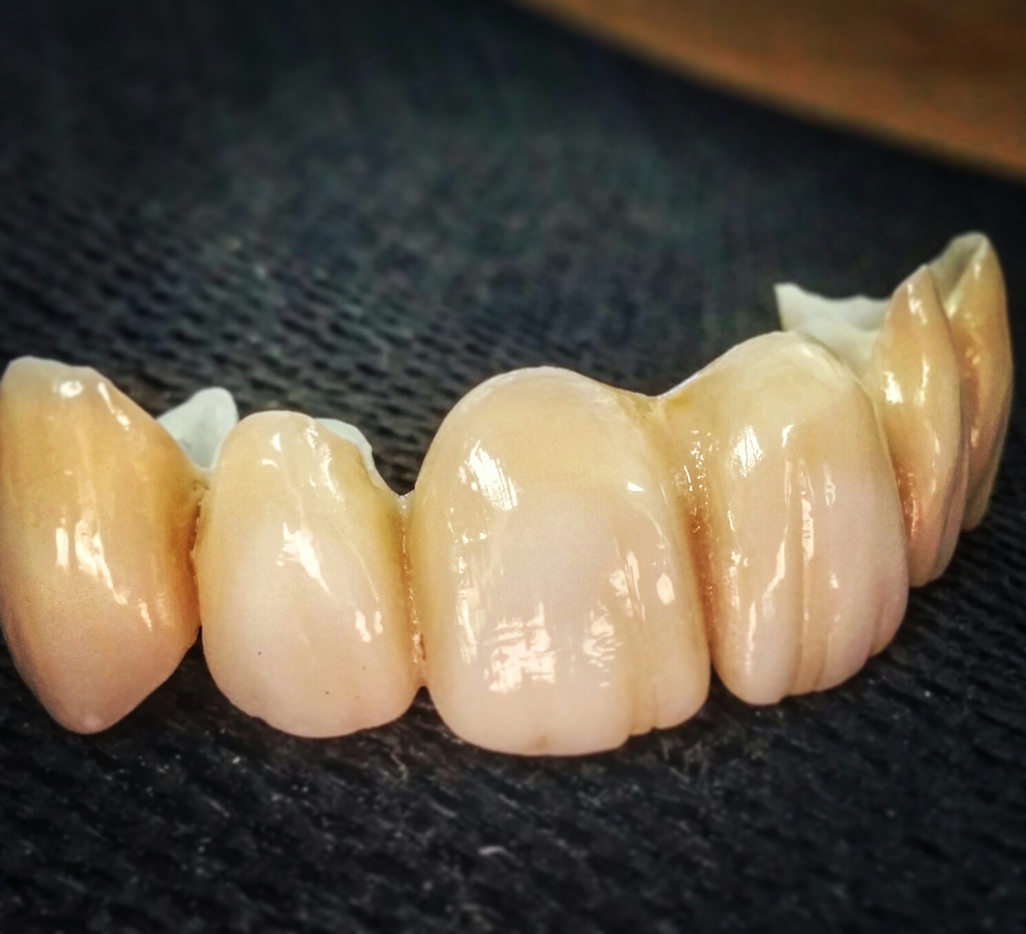 Steve's Precision Dental