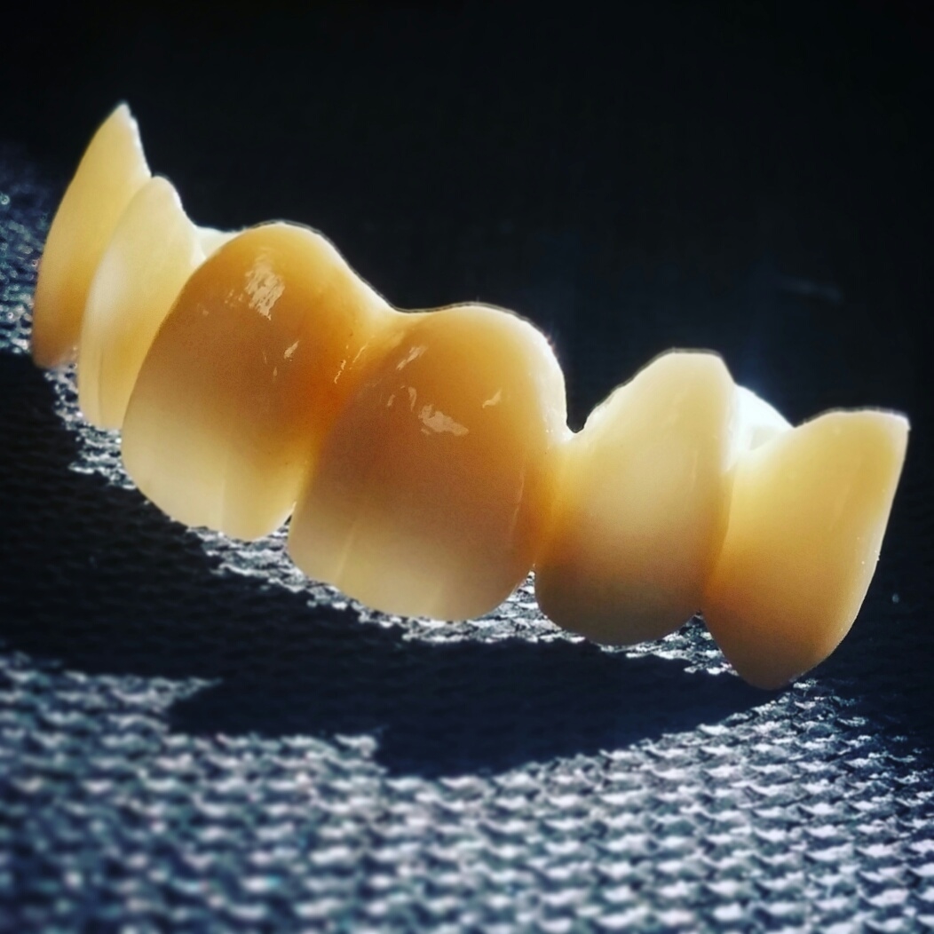 Steve's Precision Dental