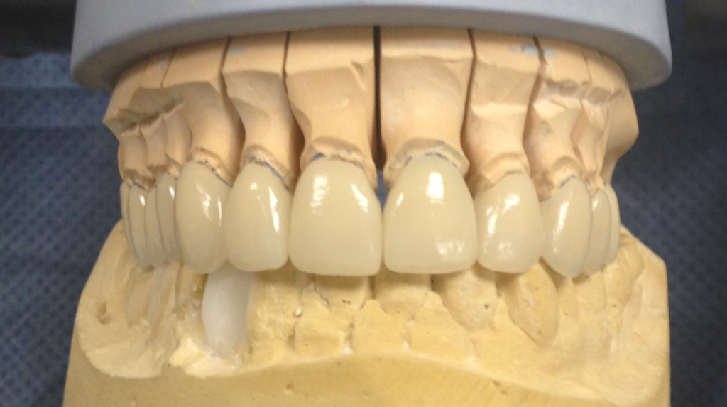 Steve's Precision Dental